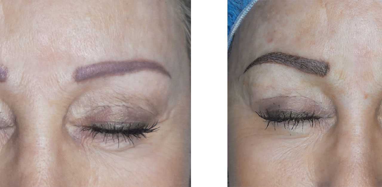 Microblading fading correction results: Woman's brows before and after